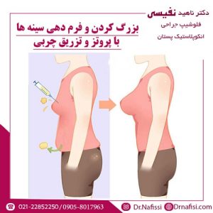 بزرگ کردن و فرم دهی سینه ها با پروتز و تزریق چربی