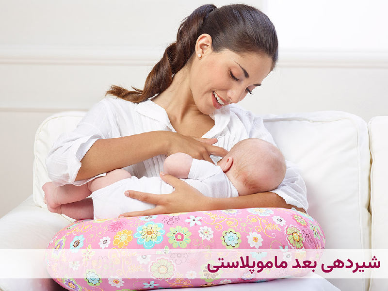 عمل ماموپلاستی چقدر طول میکشد+آیا بعدماموپلاستی می‌توان رابطه داشت+ماموپلاستی با بیمه تکمیلی انجام می‌شود+ماموپلاستی و شیردهی