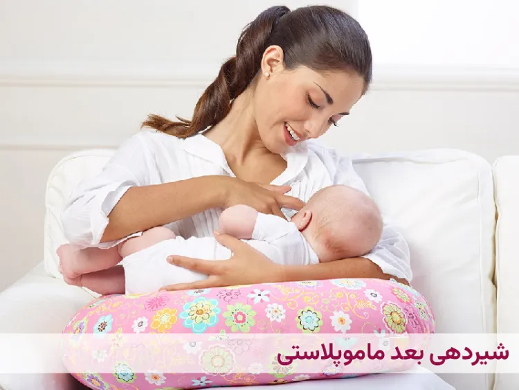 شیردهی بعد ماموپلاستی 
