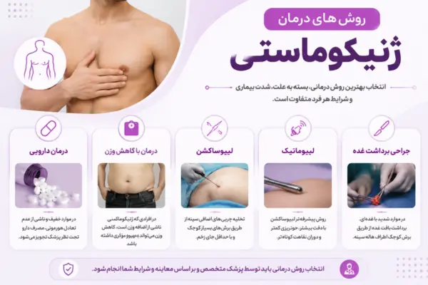 روش های درمان ژنیکوماستی