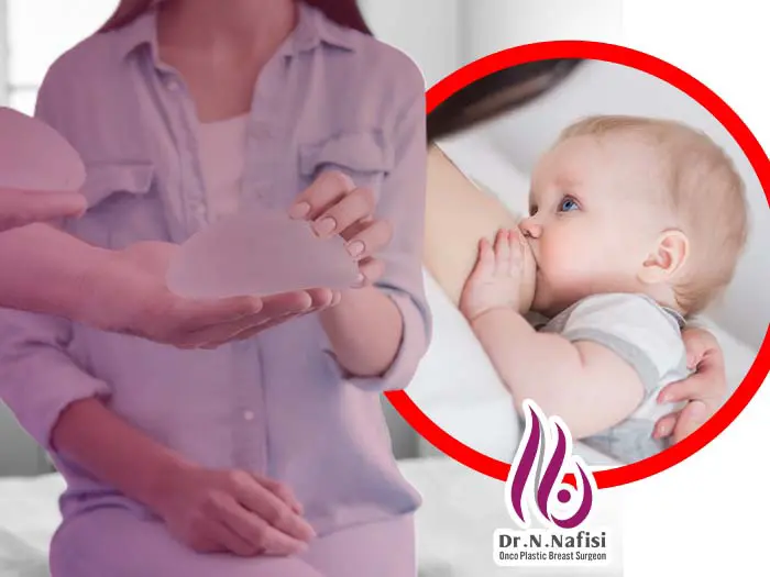 شیردهی و پروتز سینه