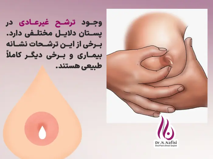 ترشحات نوک سینه