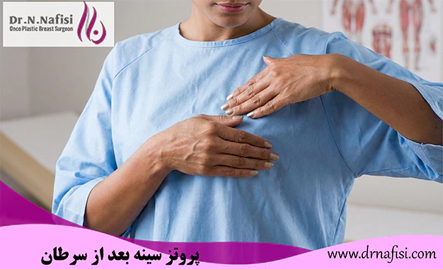 پروتز سینه بعد از سرطان