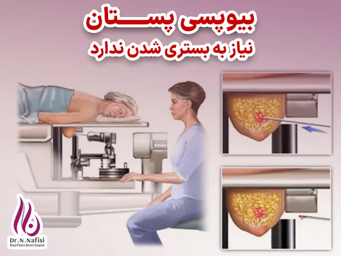 بیوپسی