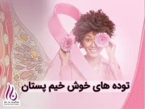 توده های خوش خیم پستان