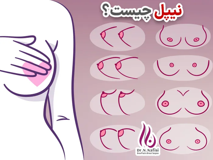 نیپل چیست؟