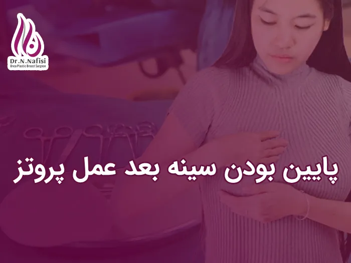 پایین بودن سینه از پروتز