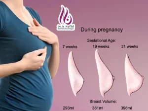 تغییرات شکل سینه در بارداری