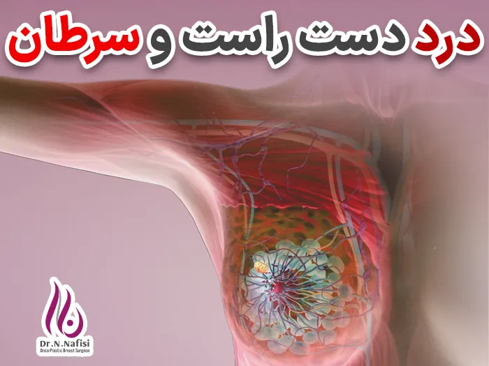رابطه درد دست راست و سرطان