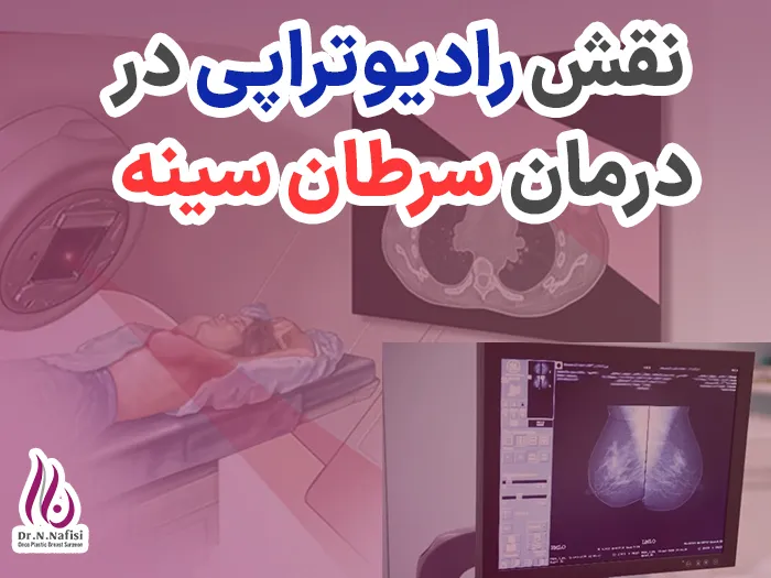 رادیوتراپی در درمان سرطان سینه