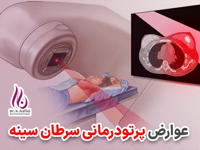 عوارض پرتو درمانی سینه