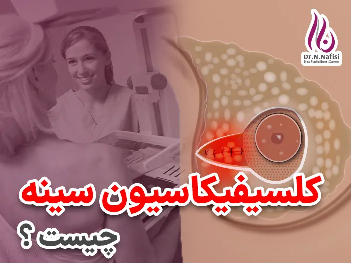 کلسیفیکاسیون سینه چیست