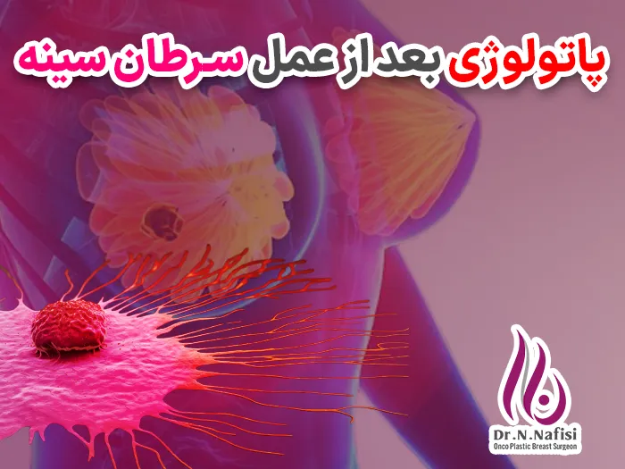 گزارش پاتولوژی سرطان سینه