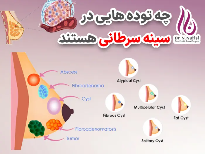 ویژگی توده های سرطانی
