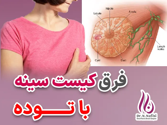 فرق کیست و توده سینه