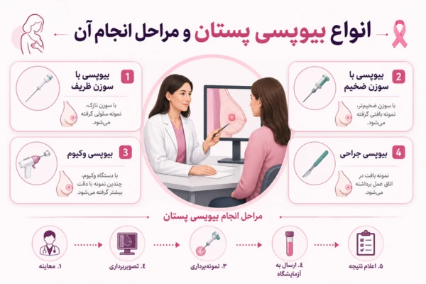 انواع بیوپسی پستان و مراحل انجام آن