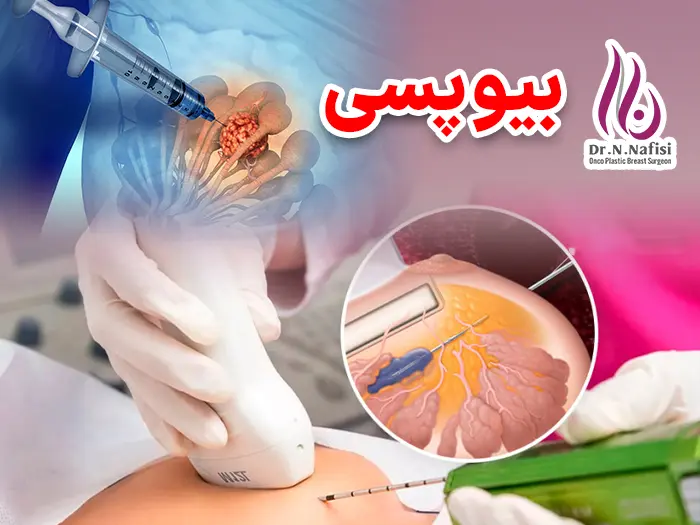 بیوپسی