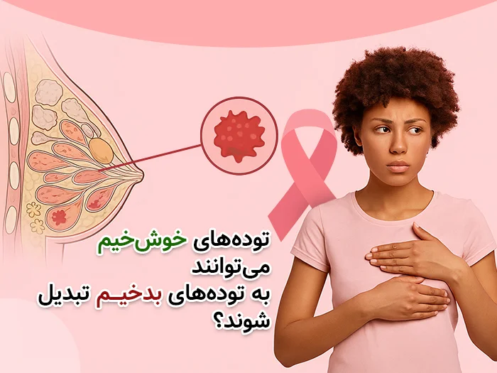 توده های خوش خیم پستان