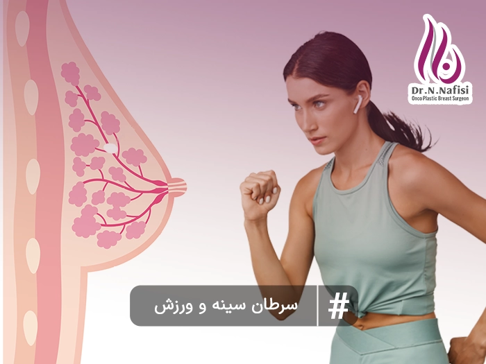 سرطان سینه و ورزش
