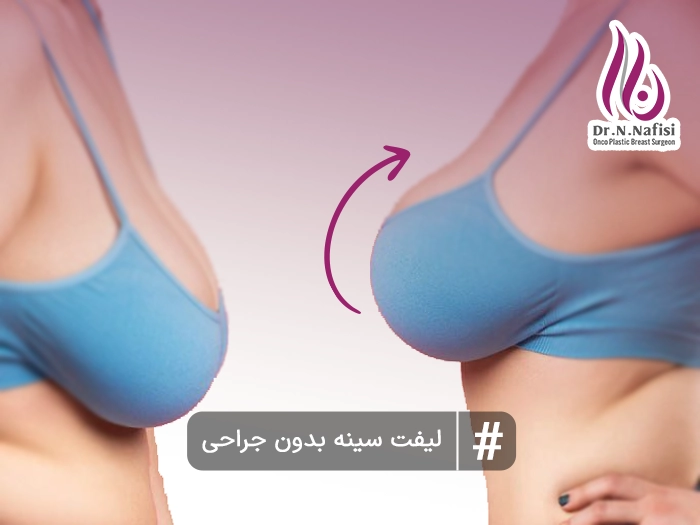 لیفت سینه بدون جراحی
