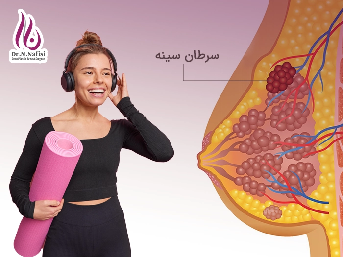 ورزش و سرطان سینه