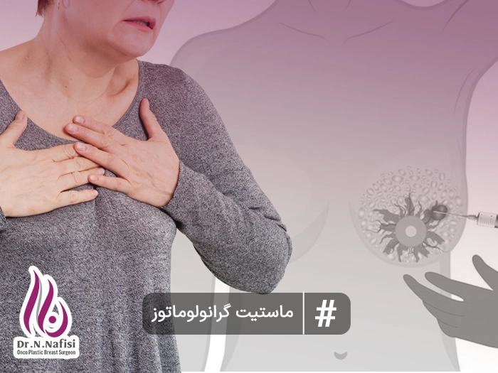 ماستیت گرانولوماتوز