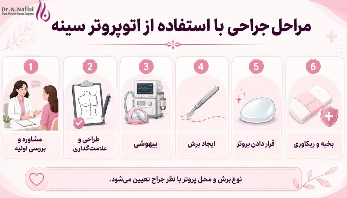 مراحل جراحی با استفاده از اتوپروتز سینه