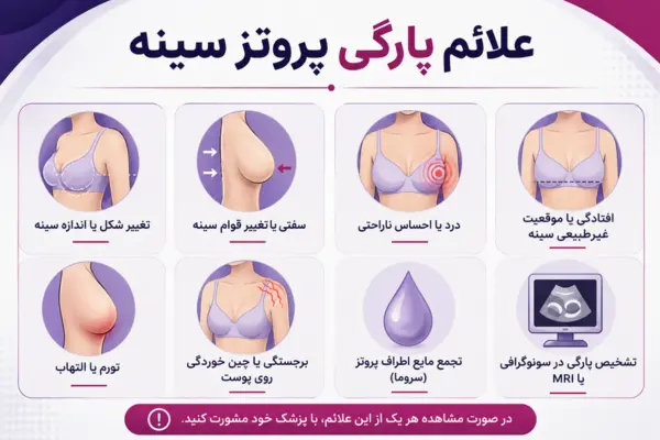 علائم پارگی پروتز سينه