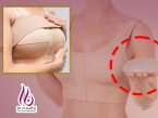 نقاهت بعد جراحی زیبایی سینه