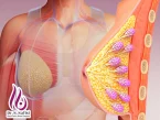بزرگ کردن سینه