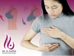جراحی بالا بردن سینه