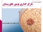 مارکر گذاری تومور های پستان