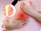 ماستیت